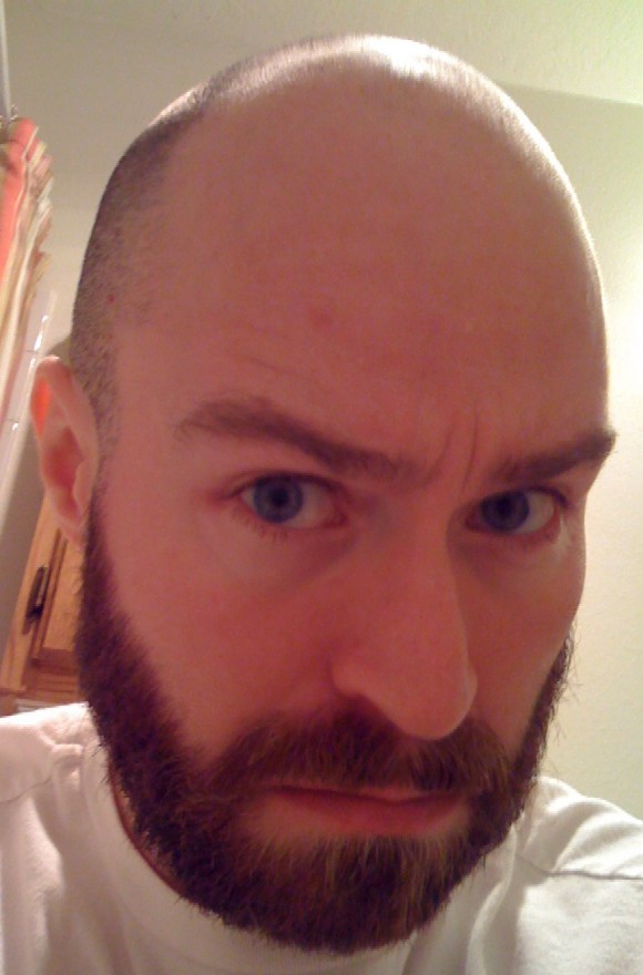 Beard-bald.JPG