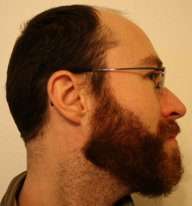 Beard-side.JPG